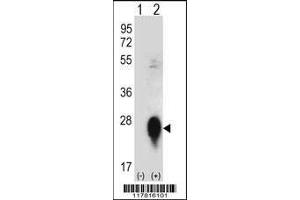 Image no. 2 for anti-C-Type Lectin Domain Family 3, Member B (CLEC3B) (AA 95-122) antibody (ABIN656570)