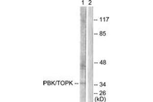 Image no. 1 for anti-PDZ Binding Kinase (PBK) (AA 1-50) antibody (ABIN1532473)