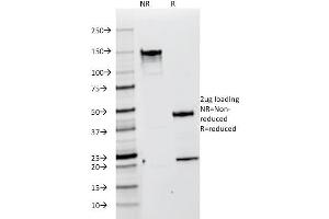 Image no. 1 for anti-Premelanosome Protein (PMEL) antibody (ABIN6940583)