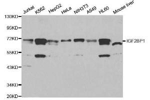 Image no. 2 for anti-Insulin-Like Growth Factor 2 mRNA Binding Protein 1 (IGF2BP1) antibody (ABIN6142239)