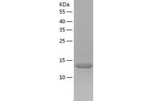 PKC epsilon Protein (AA 580-737) (His tag)