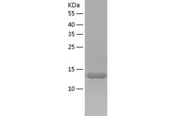 PKC epsilon Protein (AA 580-737) (His tag)
