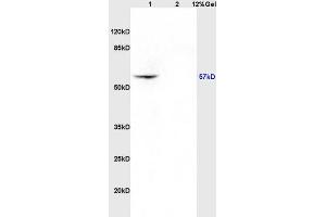 Image no. 2 for anti-Keratin 4 (KRT4) (AA 256-360) antibody (ABIN730828)