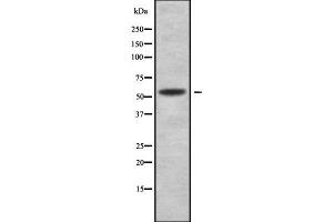 Image no. 1 for anti-Alpha2 Antiplasmin (SERPINF2) (C-Term) antibody (ABIN6265013)