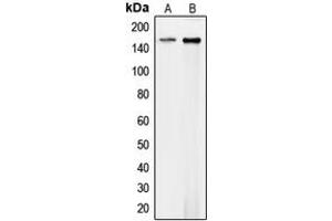 Image no. 2 for anti-Collagen, Type IV, alpha 1 (COL4A1) (N-Term) antibody (ABIN2707437)