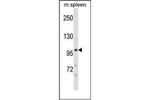 Image no. 1 for anti-Desmocollin 3 (DSC3) (AA 821-850), (C-Term) antibody (ABIN951890)