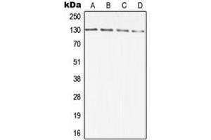 Image no. 1 for anti-Diaphanous Homolog 2 (DIAPH2) (Center) antibody (ABIN2706037)