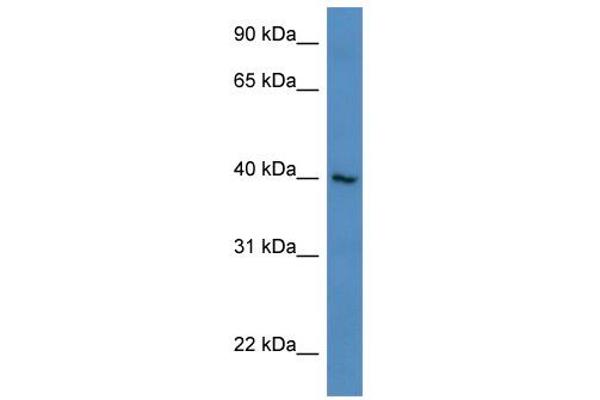 anti-Zinc Finger Protein 821 (ZNF821) (N-Term) antibody