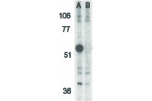Image no. 3 for anti-Caspase 12 (Gene/pseudogene) (CASP12) (Internal Region) antibody (ABIN6657740)