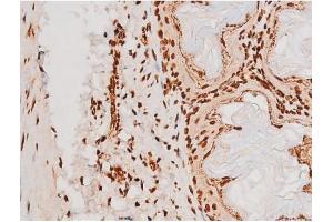 Image no. 12 for anti-REL proto-oncogene (c-Rel) (pSer503) antibody (ABIN6255382)