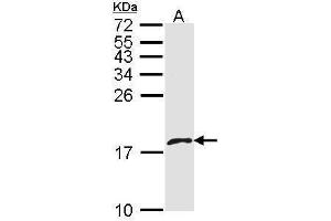Image no. 3 for anti-Platelet Factor 4 Variant 1 (PF4V1) (C-Term) antibody (ABIN2856606)