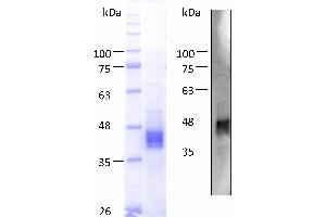 Western Blotting (WB) image for Proline Rich, Lacrimal 1 (PROL1) (AA 22-248) protein (His tag) (ABIN3086623)