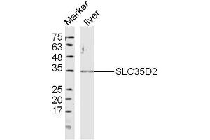 Image no. 1 for anti-Solute Carrier Family 35 (UDP-GlcNAc/UDP-Glucose Transporter), Member D2 (SLC35D2) (AA 251-326) antibody (ABIN5674961)