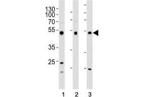Western blot analysis of lysate from (1) HepG2, (2) HT-29, and (3) SW620 cell line using FOXA2 antibody at 1:1000.