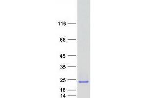 Image no. 1 for Crystallin, gamma D (CRYGD) protein (Myc-DYKDDDDK Tag) (ABIN2721678)