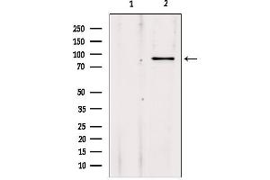 Image no. 3 for anti-Adenosine Deaminase, RNA-Specific, B1 (ADARB1) antibody (ABIN6257927)