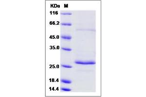 Image no. 1 for RAB27B, Member RAS Oncogene Family (RAB27B) (AA 2-215) protein (ABIN2006664)