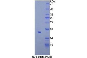 Image no. 1 for CD160 (CD160) (AA 37-154) protein (His tag) (ABIN1878745)