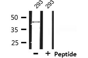 Image no. 3 for anti-Synovial Sarcoma Translocation, Chromosome 18 (SS18) (N-Term) antibody (ABIN6265410)