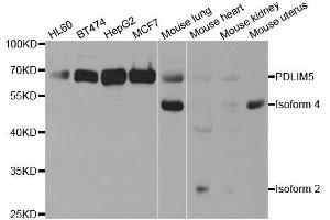Image no. 1 for anti-PDZ and LIM Domain 5 (PDLIM5) antibody (ABIN6145402)