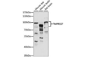 Image no. 1 for anti-Transmembrane Protease, Serine 7 (TMPRSS7) antibody (ABIN6294019)
