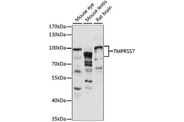 anti-Transmembrane Protease, Serine 7 (TMPRSS7) antibody