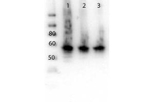 Image no. 2 for anti-Asparagine-Linked Glycosylation 6, alpha-1,3-Glucosyltransferase Homolog (ALG6) (N-Term) antibody (ABIN5596902)