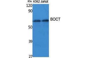 Image no. 1 for anti-Solute Carrier Family 22 (Organic Cation Transporter), Member 17 (SLC22A17) (Internal Region) antibody (ABIN3187626)