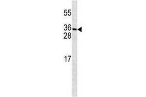 Image no. 1 for anti-Platelet-Derived Growth Factor C (PDGFC) (AA 74-103) antibody (ABIN3032248)