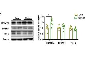 Effect of PS on DNMT and demethylase in adolescence.