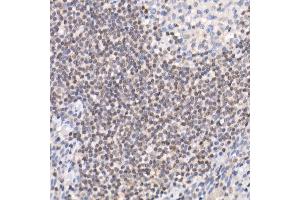 CRTC3 antibody