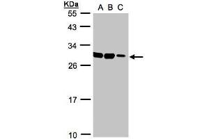 Image no. 2 for anti-Ankyrin Repeat and SOCS Box Containing 9 (ASB9) (Center) antibody (ABIN2856497)