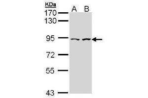 Image no. 4 for anti-Catenin (Cadherin-Associated Protein), alpha-Like 1 (CTNNAL1) (Internal Region) antibody (ABIN2856851)