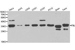 Image no. 1 for anti-Fibrillarin (FBL) antibody (ABIN6567124)