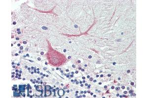 TRIM71 antibody  (AA 390-402)