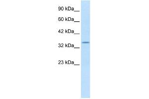 anti-Potassium Voltage-Gated Channel, Shaker-Related Subfamily, beta Member 2 (KCNAB2) (C-Term) antibody
