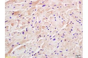 Formalin-fixed and paraffin embedded rat cardiac muscle labeled with Rabbit Anti M Cadherin Polyclonal Antibody, Unconjugated (ABIN719831) at 1:200 followed by conjugation to the secondary antibody and DAB staining