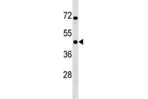 Image no. 2 for anti-Inhibitor of KB Kinase beta Interacting Protein (IKbIP) (AA 319-345) antibody (ABIN3028736)