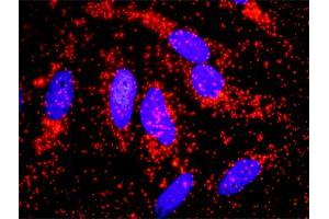 Proximity Ligation Assay (PLA) image for ACTN4 & CTNNB1 Protein Protein Interaction Antibody Pair (ABIN1339891)