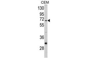 Image no. 1 for anti-Mitochondrially Encoded NADH Dehydrogenase 5 (MT-ND5) (C-Term) antibody (ABIN453212)