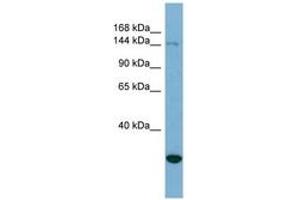 Image no. 1 for anti-Jumonji, AT Rich Interactive Domain 2 (JARID2) (AA 215-264) antibody (ABIN6741955)