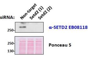anti-SET Domain Containing 2 (SETD2) (Internal Region) antibody