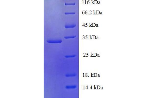 Ubiquitin-Conjugating Enzyme E2 Variant 2 (UBE2V2) (AA 2-145) protein (His-SUMO Tag)