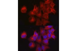 Immunofluorescence analysis of MCF7 cells using CDKN3 Rabbit pAb (ABIN3022821, ABIN3022822, ABIN3022823, ABIN1512750 and ABIN6219244) at dilution of 1:100 (40x lens).