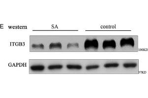 Image no. 12 for anti-Glyceraldehyde-3-Phosphate Dehydrogenase (GAPDH) antibody (ABIN3020541)