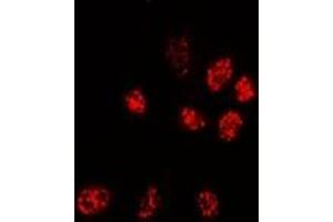 Image no. 2 for anti-Protein Phosphatase 3, Catalytic Subunit, alpha Isoform (PPP3CA) (full length) antibody (ABIN6005974)