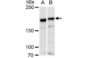 Image no. 1 for anti-rho-Associated, Coiled-Coil Containing Protein Kinase 1 (ROCK1) (N-Term) antibody (ABIN2856887)