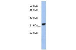 Image no. 1 for anti-Cytochrome C1 (CYC1) (Middle Region) antibody (ABIN631089)
