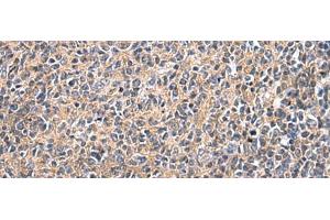 Immunohistochemistry of paraffin-embedded Human tonsil tissue using UBTD1 Polyclonal Antibody at dilution of 1:25(x200)
