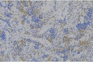 Image no. 1 for anti-CD164 (CD164) (Internal Region) antibody (ABIN6260579)